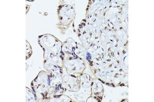 Immunohistochemistry of paraffin-embedded human placenta using HNRNPL antibody (ABIN6128048, ABIN6141915, ABIN6141917 and ABIN6216076) at dilution of 1:100 (40x lens). (HNRNPL anticorps  (AA 282-589))