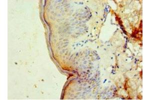 Immunohistochemistry of paraffin-embedded human skin tissue using ABIN7150514 at dilution of 1:100 (DNAJB2 anticorps  (AA 2-324))