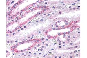 Kidney renal tubules stained with ABIN121986 (Serotonin Receptor 2B anticorps  (N-Term))