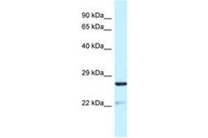 Image no. 1 for anti-Yip1 Domain Family, Member 5 (YIPF5) (AA 54-103) antibody (ABIN6747764) (YIPF5 anticorps  (AA 54-103))