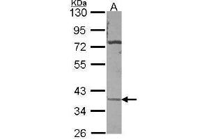 WB Image Sample (30 ug of whole cell lysate) A: A431 , 10% SDS PAGE antibody diluted at 1:500 (CA11 anticorps)