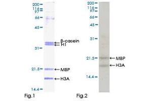Kinase Activity Assay (KAA) image for Ribosomal Protein S6 Kinase, 90kDa, Polypeptide 5 (RPS6KA5) (AA 1-549) protein (GST tag) (ABIN1318830)