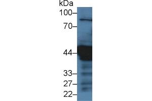 Western blot analysis of Human HeLa (3u) cell lysate, using Pig KRT18 Antibody (3 µg/ml) and HRP-conjugated Goat Anti-Rabbit antibody ( (Cytokeratin 18 anticorps  (AA 1-159))