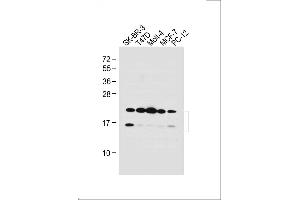 All lanes : Anti-UBE2W Antibody (C-term) at 1:1000 dilution Lane 1: SK-BR-3 whole cell lysate Lane 2: T47D whole cell lysate Lane 3: Molt-4 whole cell lysate Lane 4: MCF-7 whole cell lysate Lane 5: PC-12 whole cell lysate Lysates/proteins at 20 μg per lane. (UBE2W anticorps  (C-Term))