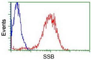 Image no. 6 for anti-Sjogren Syndrome Antigen B (SSB) antibody (ABIN1501143)