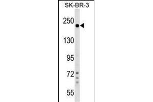 SHROOM2 Antibody (Center) (ABIN1538525 and ABIN2849363) western blot analysis in SK-BR-3 cell line lysates (35 μg/lane). (SHROOM2 anticorps  (AA 599-625))
