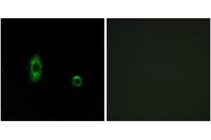 Immunofluorescence analysis of A549 cells, using CXG2 Antibody. (GJC2 anticorps  (AA 21-70))