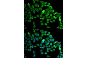 Immunofluorescence analysis of MCF-7 cells using CUL2 antibody (ABIN5975808). (Cullin 2 anticorps)