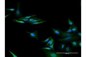 Immunofluorescence of purified MaxPab antibody to C13orf18 on HeLa cell. (C13orf18 anticorps  (AA 1-595))