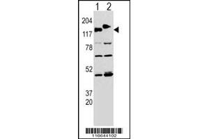 Western blot analysis of CLASP using rabbit polyclonal CLASP Antibody (Y1019) using 293 cell lysates transfected with the ACADL gene (Lane 1) and with the GFP-CLASP (Lane 2).