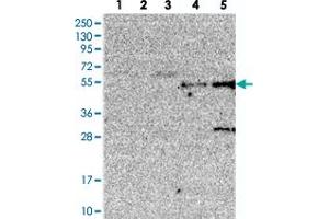Western blot analysis of Lane 1: RT-4, Lane 2: U-251 MG, Lane 3: Human Plasma, Lane 4: Liver, Lane 5: Tonsil with TMEM39B polyclonal antibody .
