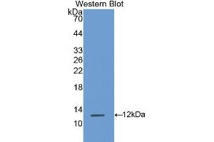 Detection of Recombinant S100A8, Rat using Polyclonal Antibody to S100 Calcium Binding Protein A8 (S100A8) (S100A8 anticorps  (AA 1-89))