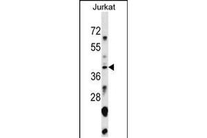 Western blot analysis in Jurkat cell line lysates (35ug/lane).