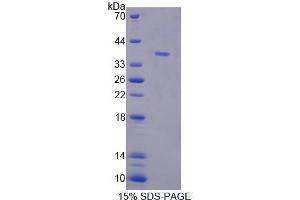 SDS-PAGE analysis of Human TECTb Protein. (TECTB Protéine)