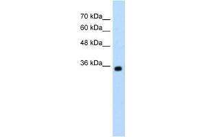 Western Blot showing ZMYND11 antibody used at a concentration of 1-2 ug/ml to detect its target protein.