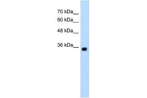 Western Blot showing ZMYND11 antibody used at a concentration of 1-2 ug/ml to detect its target protein. (ZMYND11 anticorps  (N-Term))