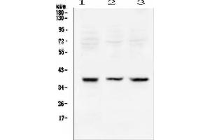 Western blot analysis of Rad51 using anti-Rad51 antibody (ABIN6719396). (RAD51 anticorps)