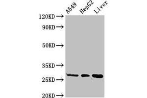 Western Blot Positive WB detected in: A549 whole cell lysate, HepG2 whole cell lysate, Rat liver tissue All lanes: PSMA5 antibody at 3 μg/mL Secondary Goat polyclonal to rabbit IgG at 1/50000 dilution Predicted band size: 27, 21 kDa Observed band size: 27 kDa (PSMA5 anticorps  (AA 124-180))