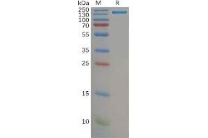 Human CD21 Protein, hFc Tag on SDS-PAGE under reducing condition.