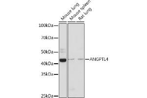 Western blot analysis of extracts of various cell lines, using  Rabbit pAb (ABIN3015826, ABIN3015827, ABIN3015828 and ABIN6219178) at 1:500 dilution.