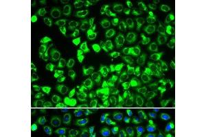 Immunofluorescence analysis of HeLa cells using DLD Polyclonal Antibody (DLD anticorps)