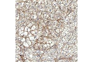 IHC analysis of PTRF/CAVIN1 using anti-PTRF/CAVIN1 antibody (ABIN7601817). (PTRF anticorps  (AA 47-390))