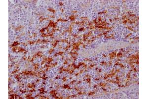 IHC image of ABIN7181209 diluted at 1:100 and staining in paraffin-embedded human tonsil tissue performed on a Leica BondTM system. (Fascin anticorps)