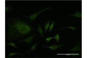 Immunofluorescence of monoclonal antibody to PCNA on HeLa cell.