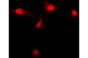 Immunofluorescent analysis of Galectin 3 staining in Jurkat cells. (Galectin 3 anticorps  (Center))