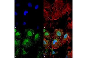 Immunocytochemistry/Immunofluorescence analysis using Mouse Anti-mGluR1/5 glutamate receptor Monoclonal Antibody, Clone S75-3 .