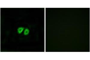 Immunofluorescence analysis of MCF7 cells, using GPR56 Antibody.