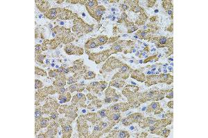 Immunohistochemistry of paraffin-embedded human liver injury using PHF1 antibody (ABIN5974685) at dilution of 1/100 (40x lens). (PHF1 anticorps)