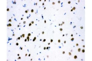 IHC testing of frozen rat brain tissue with ATF2 antibody at 1ug/ml. (ATF2 anticorps  (AA 93-450))