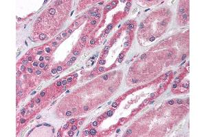 Anti-MBD1 antibody IHC of human kidney.