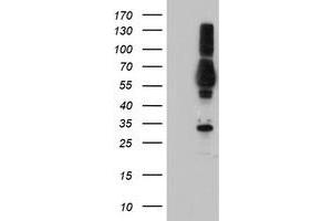Western Blotting (WB) image for anti-Tubby Like Protein 3 (TULP3) antibody (ABIN1501585) (TULP3 anticorps)
