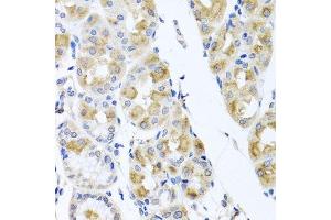 Immunohistochemistry of paraffin-embedded human stomach using TMEM43 antibody. (TMEM43 anticorps  (AA 80-310))
