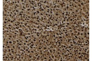 anti-Phosphoinositide 3 Kinase, p85 beta (PI3K p85b) (C-Term) antibody