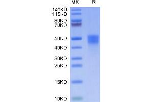 Cynomolgus M-CSF on Tris-Bis PAGE under reduced condition. (M-CSF/CSF1 Protein (AA 33-255) (His tag))