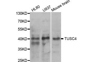 Western blot analysis of extracts of various cell lines, using NPRL2 antibody (ABIN5973470) at 1/1000 dilution. (NPRL2 anticorps)