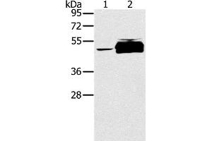 Western Blot analysis of K562 cell and Human testis tissue using PTPN20 Polyclonal Antibody at dilution of 1:200 (PTPN20 anticorps)