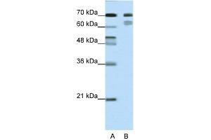 WB Suggested Anti-TCF3 Antibody Titration:  0. (TCF3 anticorps  (N-Term))