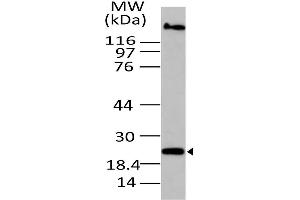 Image no. 1 for anti-Oxidized Low Density Lipoprotein (Lectin-Like) Receptor 1 (OLR1) (AA 1-200) antibody (ABIN5027116)