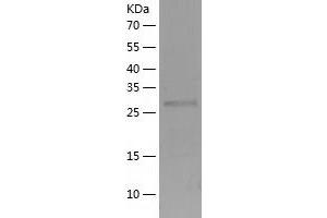 Western Blotting (WB) image for PH Domain and Leucine Rich Repeat Protein Phosphatase 2 (PHLPP2) (AA 766-1043) protein (His-IF2DI Tag) (ABIN7124383)