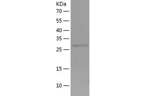 PHLPP2 Protein (AA 766-1043) (His tag)