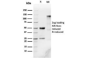 SDS-PAGE Analysis Purified IgM Recombinant Rabbit Monoclonal Antibody (IGHM/3776R). (Recombinant IGHM anticorps)