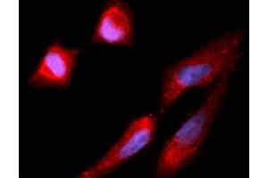 Immunofluorescence (IF) image for anti-Carboxypeptidase E (CPE) (AA 43-476) antibody (APC) (ABIN5565194) (CPE anticorps  (AA 43-476) (APC))