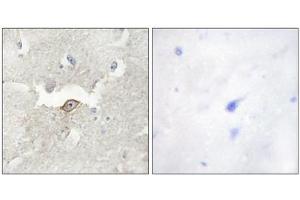 Immunohistochemistry analysis of paraffin-embedded human brain tissue using LMTK2 antibody. (LMTK2 anticorps  (Internal Region))