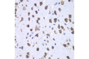 Immunohistochemistry of paraffin-embedded mouse brain using UPF1 antibody at dilution of 1:100 (x40 lens). (RENT1/UPF1 anticorps)