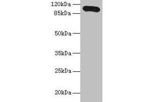 Western blot All lanes: Thbs3 antibody at 16 μg/mL + HepG2 whole cell lysate Secondary Goat polyclonal to rabbit IgG at 1/10000 dilution Predicted band size: 105 kDa Observed band size: 105 kDa