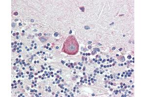 Anti-HOXA10 antibody IHC staining of human brain, cerebellum. (HOXA10 anticorps  (AA 152-165))